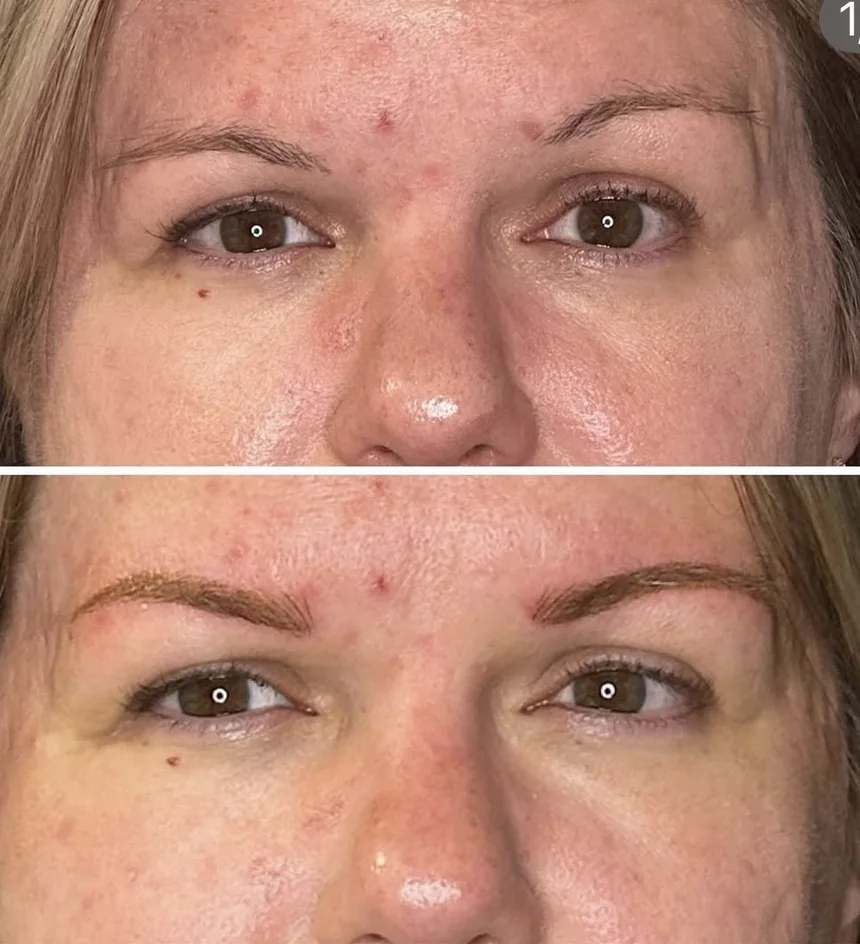Before and after of a brow tattoo: light brows defined into a fuller, natural shape