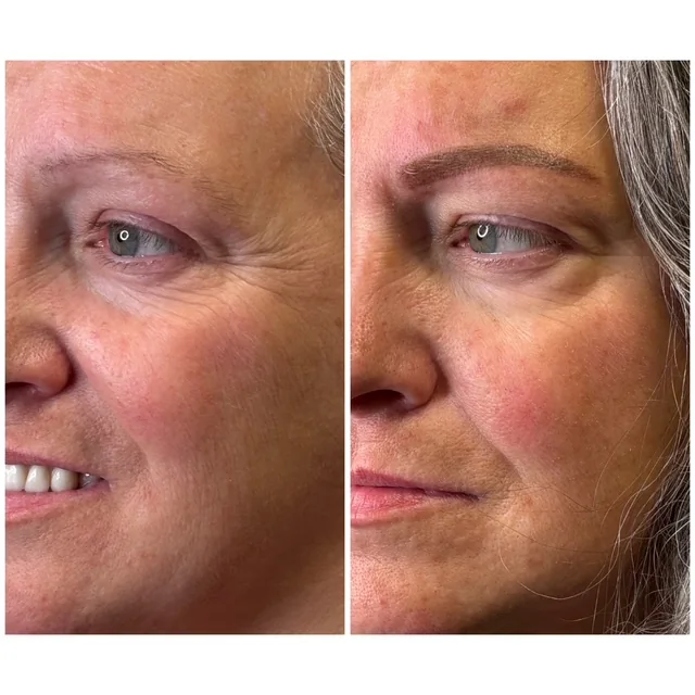 Before and after of a brow tattoo shown in profile: a soft, defined natural brow shape
